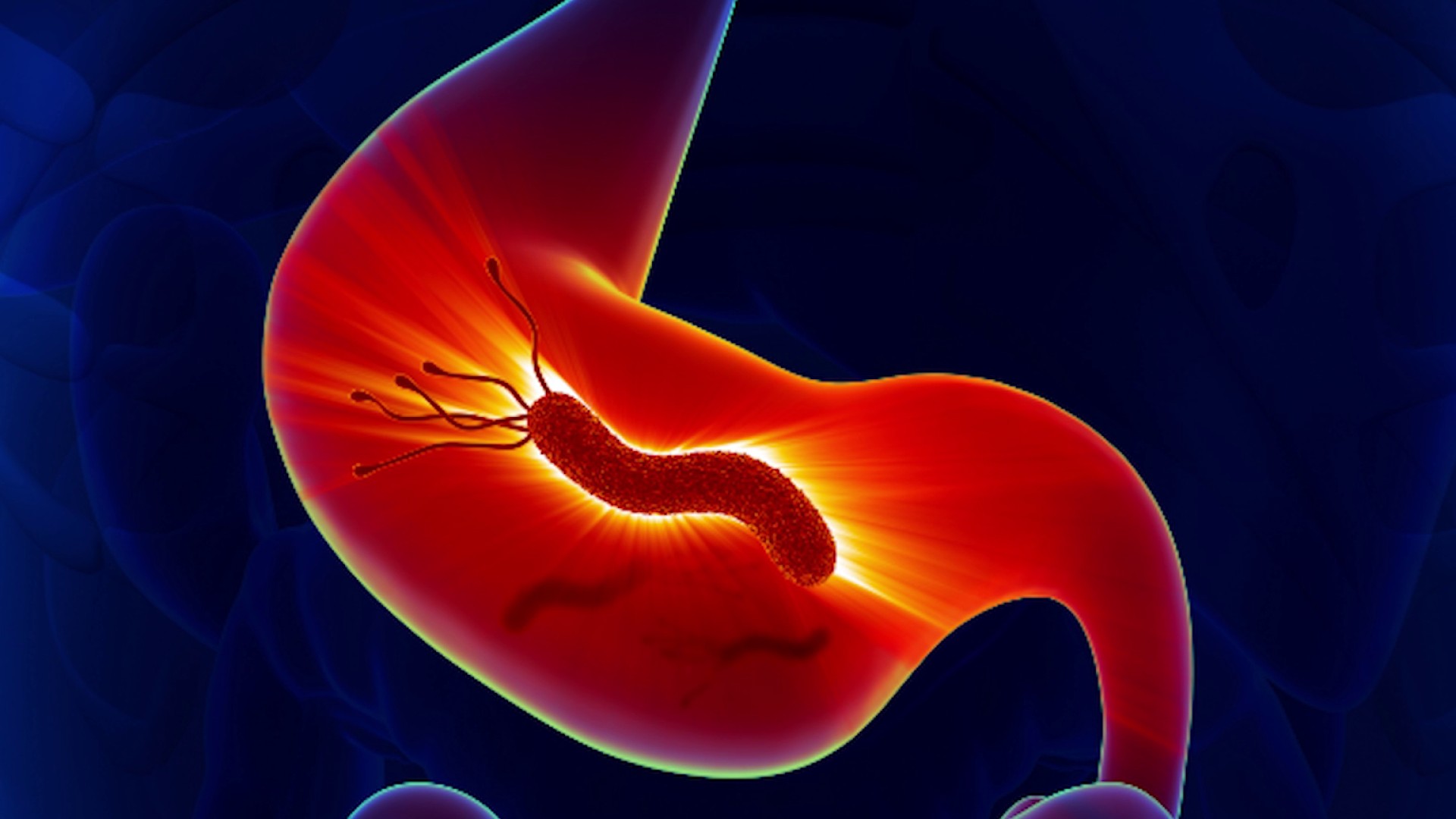 Helicobacter pylori - Canal 12 de El Salvador